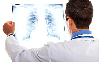 Ponad 2 tysiące osób będzie mogło sprawdzić swoje płuca. Program profilaktyki raka skierowany jest do palaczy