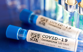 W całej Polsce 341 zachorowań na COVID-19, zmarło 11 osób. Na Warmii i Mazurach nie ma nowych zakażeń