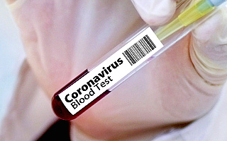 79 nowych zakażeń koronawiruem, w tym 3 w Nowym Mieście Lubawskim. Zmarły kolejne 2 osoby