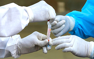 W regionie stwierdzono 869 nowych zakażeń koronawirusem. Nie żyje 13 osób