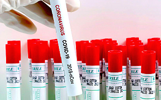 Coraz niższy odsetek pozytywnych wyników testów na koronawirusa