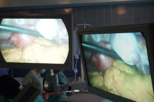 Olsztyńscy lekarze o raku jajnika: wczesne wykrycie ratuje życie