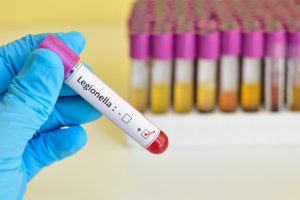 Skażenie wody w iławskim basenie miejskim. Sanepid zamyka pływalnię