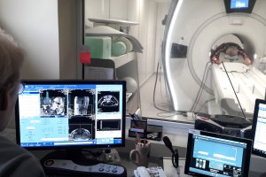 Dobra wiadomość dla pacjentów z Warmii i Mazur. Kurczą się kolejki na operację usunięcia zaćmy oraz badania tomografii i rezonansu