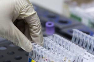 Mięso z upolowanych dzików marnuje się w chłodniach. Myśliwi powiatu olsztyńskiego winą obarczają zbyt długie badania na obecność wirusa ASF