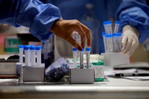 Systematyczny wzrost zakażeń koronawirusem. W regionie najwięcej przypadków w Olsztynie i okolicach