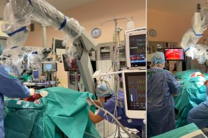 Najnowocześniejszy na świecie mikroskop neurochirurgiczny trafił do szpitala w Olsztynie