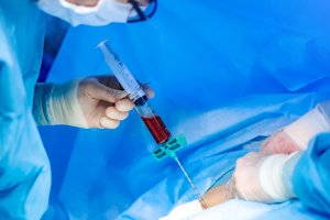 Na Zdrowie: autoprzeszczep szpiku, badania lipidowe u dzieci i kosmetyki bez tajemnic