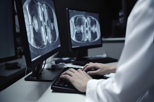 Diagnoza: nowotwory głowy i szyi. Posłuchaj audycji