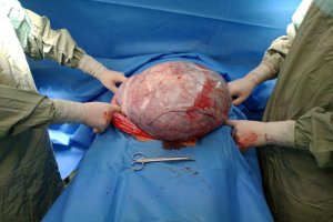 W audycji Na Zdrowie o wizytach u ginekologa. 