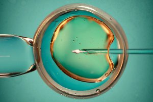 Rządowy program in vitro. Co warto wiedzieć?