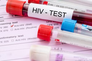 Diagnoza: rośnie liczba zakażeń HIV