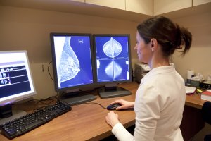 Tylko co trzecia Polka wykonuje profilaktyczną mammografię