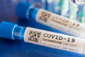Duży wzrost liczby zachorowań na COVID-19. 