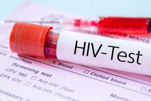 Więcej zakażeń wirusem HIV w całej Polsce