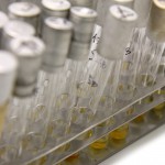 Polacy biorą za dużo antybiotyków. Co sądzą o tym eksperci?