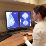 Profilaktyka raka piersi. Kobiety zachęcają kobiety do badań